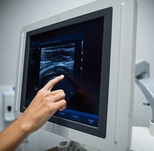 Fibroscan
