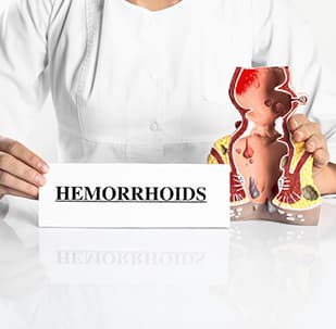 Hemorrhoid Treatment