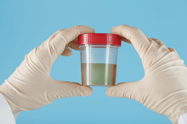What is Fecal Microbiota Transplantation (FMT)?