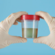 What is Fecal Microbiota Transplantation (FMT)?