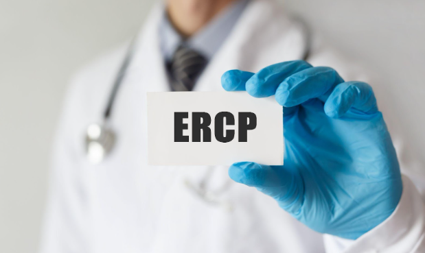 What Is ERCP?