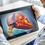 FibroScan ultrasound probe assessing liver stiffness for optimal hepatic wellness