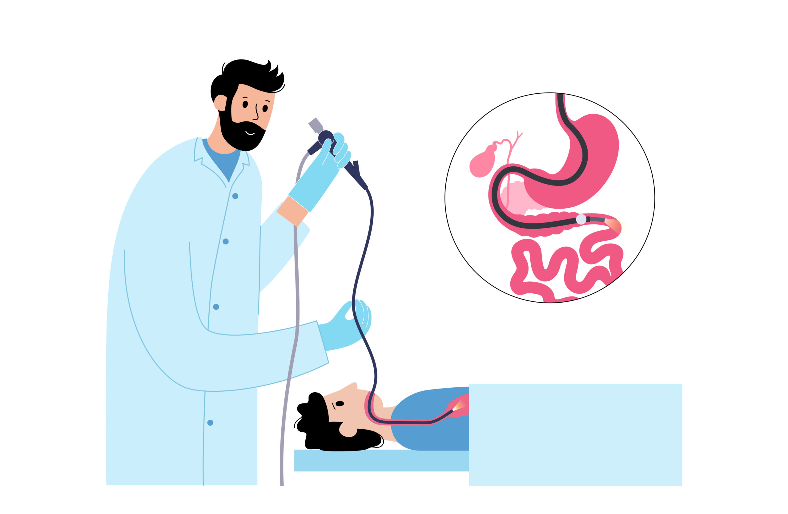 Diagram of upper endoscopy procedure process