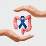 Colorectal cancer symptoms including blood in stool and back pain in young New Yorkers