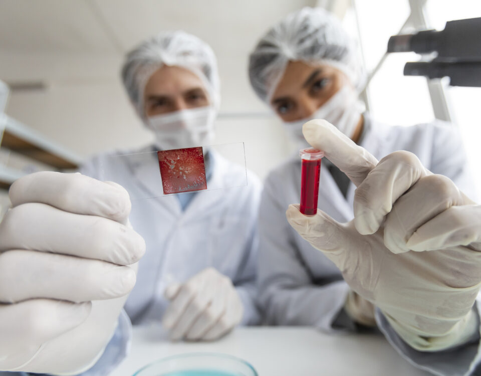 Intestine Bleeding Symptoms What Blood in Stool Means and When to Seek Urgent Care